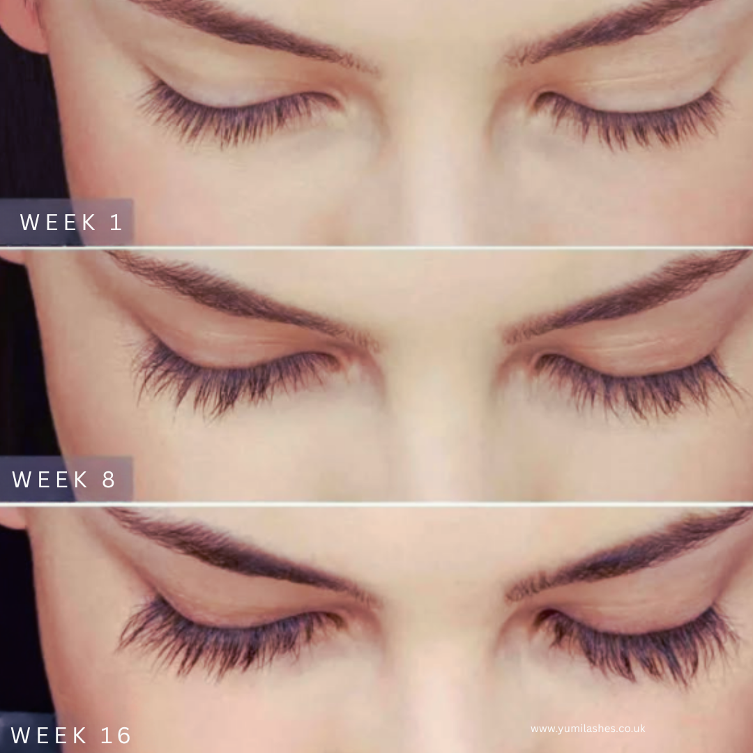 Before and after comparison of eyelash growth over 16 weeks.